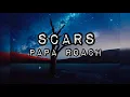 SCARS BY PAPA ROACH (LYRICS) KEIRGEEMUSICBOX