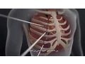 Download Lagu Minimally Invasive Valve Repair