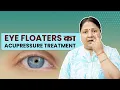 आंखों के सामने तैरते हुए धब्बों (Eye Floaters)का Acupressure इलाज #shorts