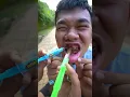 Download Lagu Người Chị Tốt Bụng làm Bác Sĩ Khám Răng cho Em Ăn Kẹo Mút Sâu Răng / Funny Video Eat Candy