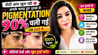 दीदी आप खुश रहो आपके बताए हुए नुस्खे से मेरी pigmentation 90% चली गई एक हफ्ते में🤗