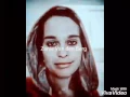 Lagu Zanie Van den Berg Amputee