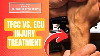 TFCC vs ECU Kinesio Tape Treatment Technique Peek Series