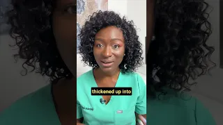 Period Clots Explained Heavy Periods 