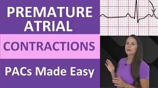 Premature Atrial Contractions PACs Nursing NCLEX Review Mnemonics ECG interpretation