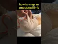 Download Lagu How to Wrap a Stump #amputation #amputee
