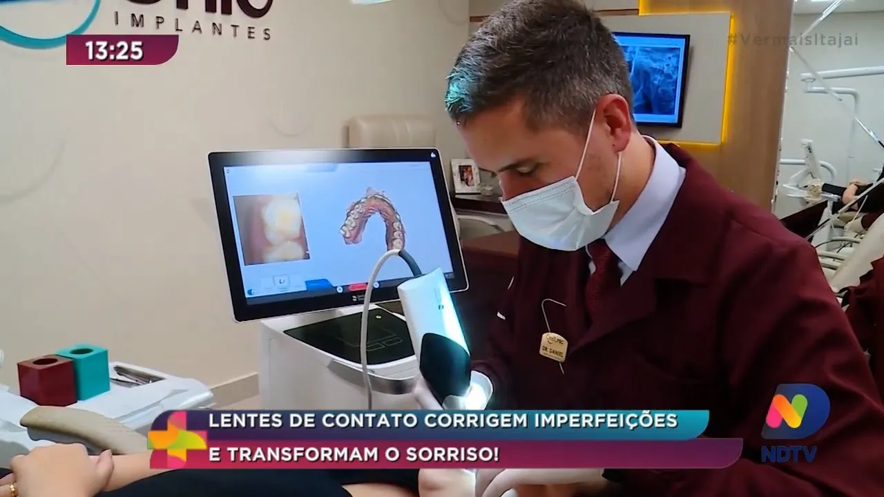 Lentes de contato corrigem imperfeições e transformam o sorriso