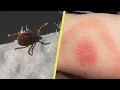 What bit me Spot the difference between a spider tick or mosquito bite - Health and Weather