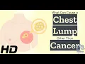 Chest Lumps Explained When It s Not a Tumor