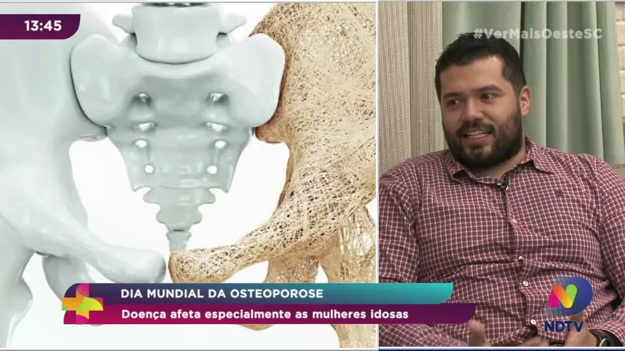 Dia Mundial da Osteoporose: doença afeta especialmente as mulheres idosas