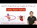 Lagu Leaky Heart Valves | Causes and Symptoms | Hindi/Urdu