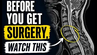 Cervical disc herniation C4 - C5 / C5 - C6 how to improve the pain.