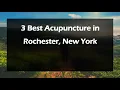 3 Best Acupuncture in Rochester New York Acupuncturists
