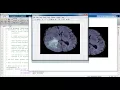 Image Processing Projects Using Opencv Image Processing Thesis Using Opencv