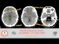 Anatomy in CT and MRI skull