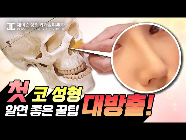 코 수술! 처음하면 이것만 알고 가자!