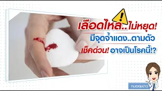 ภาวะเกล็ดเลือดต่ำคืออะไร และมีอาการอย่างไรบ้าง