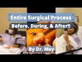 PAINLESS BUNION SURGERY