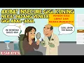 Download Lagu AKIBAT INSECURE KARENA GIGI KUNING SAMPAI NEKAT PASANG VENEER GIGI ABAL-ABAL! | SINETRON KISAH NYATA