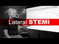 Lateral STEMI