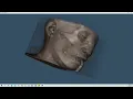 VTK Python Example - MedicalDemo4