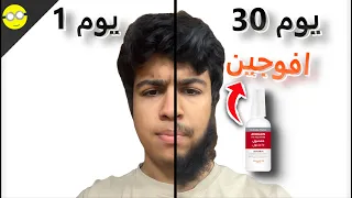 جربت الافوجين لمده 30 يوم يخلي الشعر يرجع مره ثانيه 