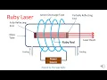 Ruby Laser