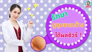 สาเหตุหลักที่ทำให้รูขุมขนกว้าง มีอะไรบ้าง และแต่ละสาเหตุเกิดจากปัจจัยใด