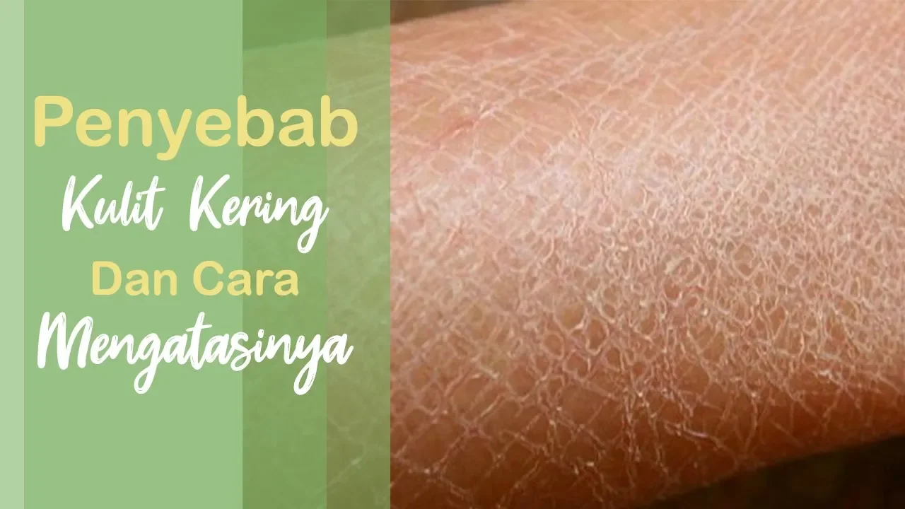 Bodycare for Dry Skin | byebye kulit kering & kulit bersisik | OKTAVOS. 