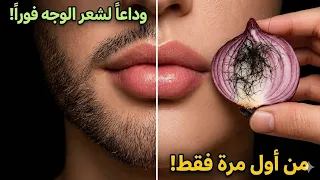 طريقة سهلة لإزالة شعر الوجه بدون ألم بالبصل 😱 أفضل وصفة طبيعية في البيت لإزالة شعر الوجه والجسم