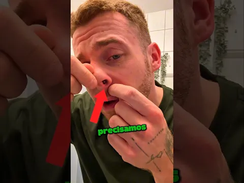 Sentiu Algo Estranho Dentro Do Nariz E Isso Aconteceu 😮👃