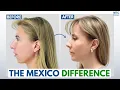 Why Thousands Are Choosing Plastic Surgery in Mexico Over the US