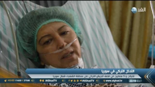 تقرير قتلى وجرحى في قصف تركي على قرى مدينة عفرين 