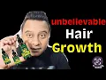 Unlock Unbelievable Hair Growth 7 Days with Ginger Oil
