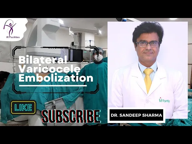 Bilateral Varicocele Embolization