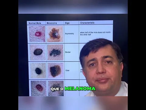 Melanoma vulvar: o perigo da pinta rosada #shorts