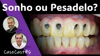 Os 6 ERROS que podem ARRUINAR seu PROTOCOLO. #protesesobreimplante #implantesdentarios #protocolo