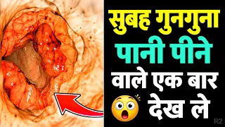 सुबह बासी मुंह गुनगुना पानी पीने के बाद शरीर में क्या होता है? जानकर हैरान रह जाएंगे! R2