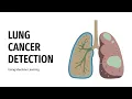 LUNG CANCER DETECTION MODEL PPT PYTHAKON 2022 PYTHON MACHINE LEARNING