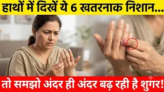 ​शुगर बढ़ने से पहले ही चेतावनी देते ये 6 निशान क्या आपके हाथों में भी दिख रहे | Diabetes Early Signs