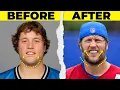 Matthew Stafford s NEW TEETH Veneer Analysis by a Dentist