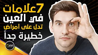 7علامات تظهر في العين تدل على مرض معين في الجسم منها أمراض خطيرة جدا خبرني  7علامات تظهر في العين تدل على مرض معين في الجسم منها أمراض خطيرة جدا خبرني