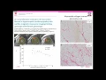 Download Lagu EuroCMR 2016 Debate: Tissue characterization using CMR mapping techniques are ready for prime time