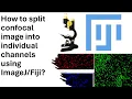 Part-4 How to split confocal image into individual channels using