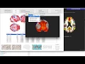 Resting state functional connectivity in CONN