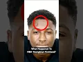Download Lagu What happened to NBA YoungBoy's forehead? 🤔