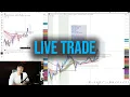 Lagu Live Day Trading Losing $8,832 (HOW TO DAY TRADE)