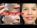 Lagu عتقوا الوصفة التي يبحث عنها الملايين من النساء😍الخيال العلمي🫨الوجه تقشر ودا معاه الكلف وزروگية سنين 