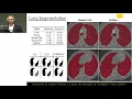 Segmentation with capsule network by Rodney Lalonde UCF
