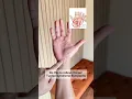 Decompress the Median Nerve to Get relief from Carpal Tunnel Syndrome